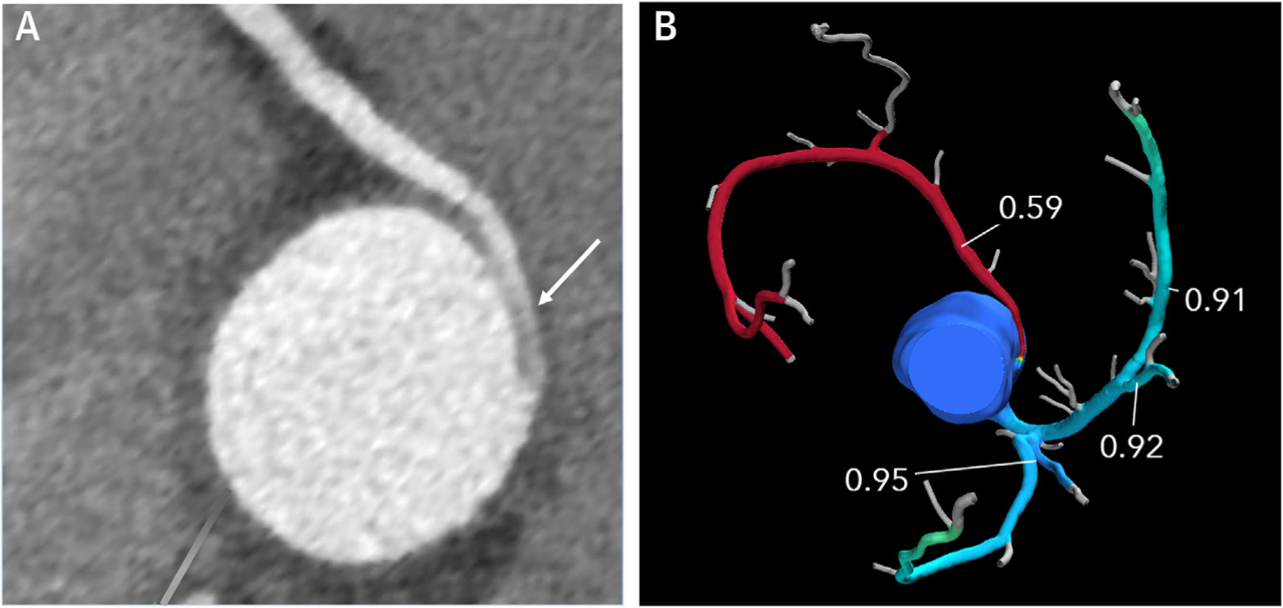 FIGURE 9