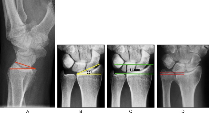 Figure 1.