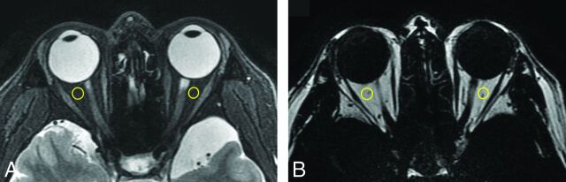 Fig 1.