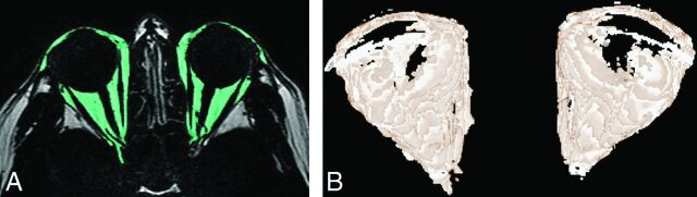 Fig 2.