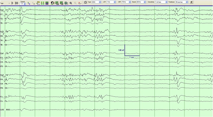 Fig. 3