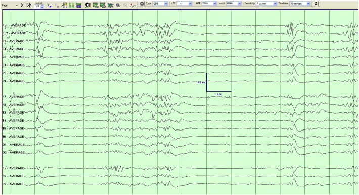 Fig. 4