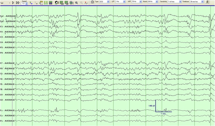 Fig. 2