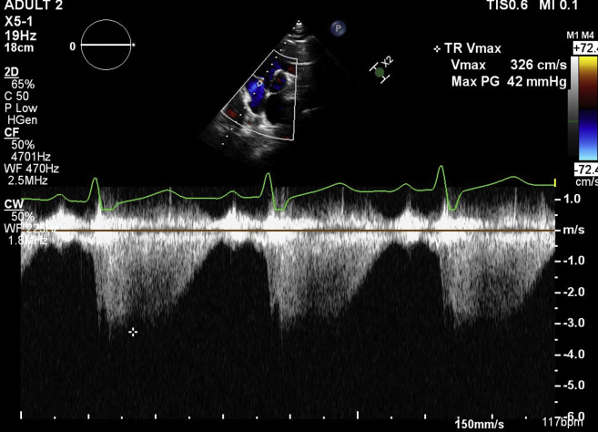 Figure 3