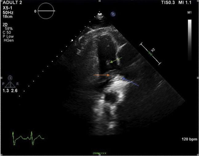 Figure 2