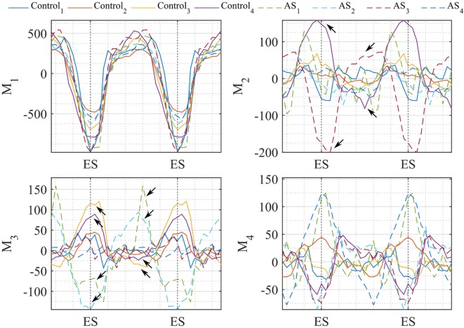 Figure 14