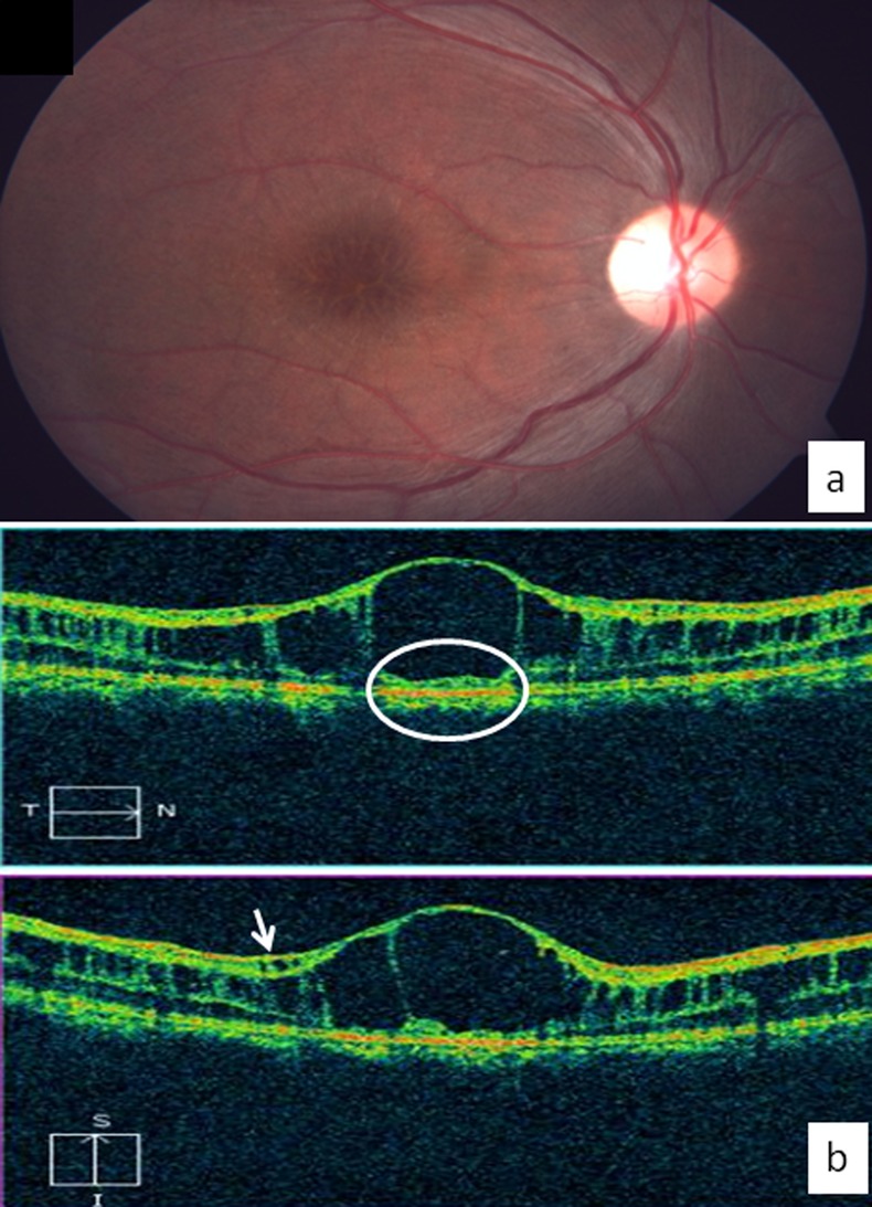 Figure 2