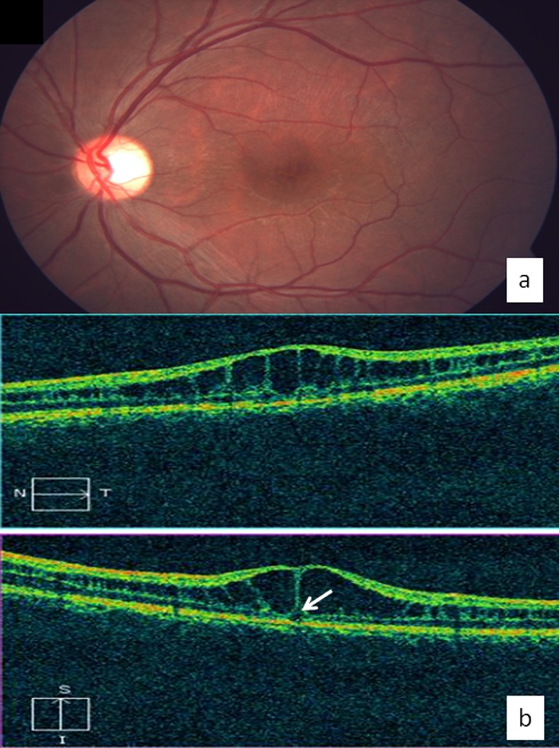 Figure 1