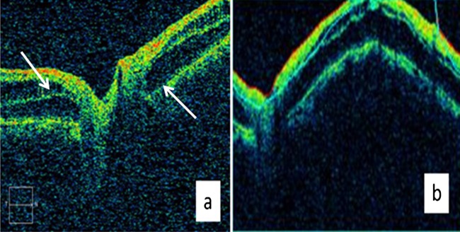 Figure 3