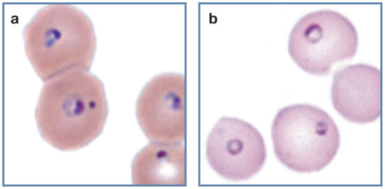 Figure 21