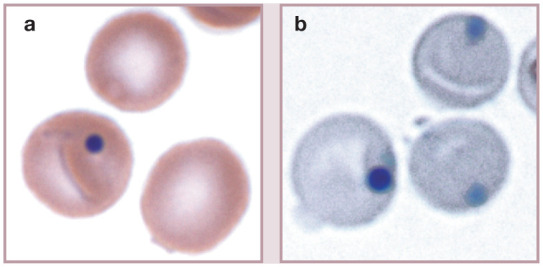 Figure 15