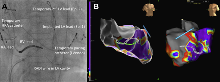 Figure 1