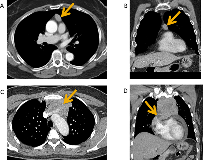 Figure 1 (A-D):