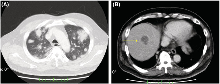 FIGURE 2