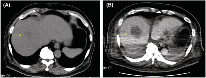 FIGURE 4