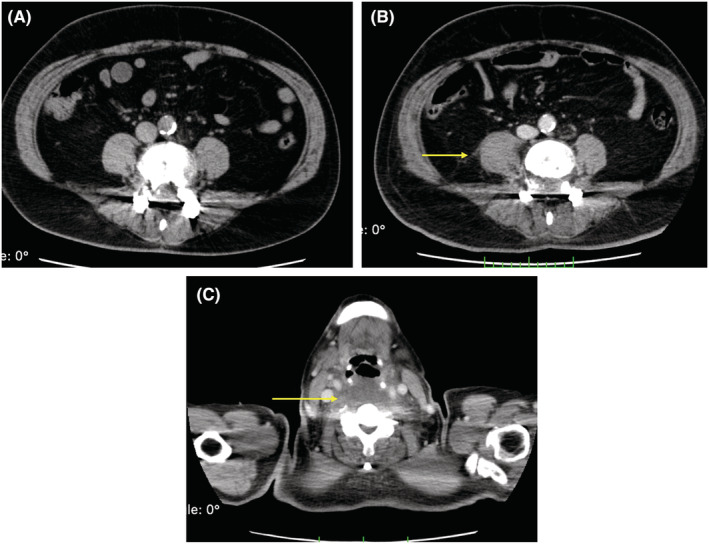 FIGURE 3