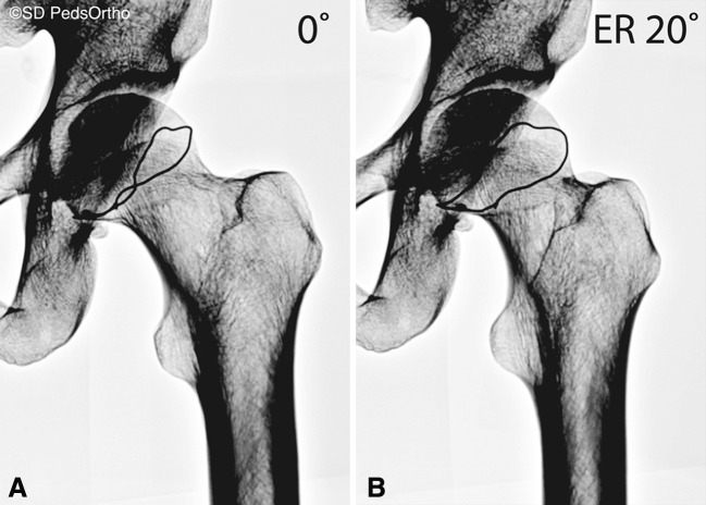 Fig. 5A–B