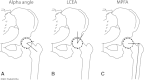 Fig. 3A–C