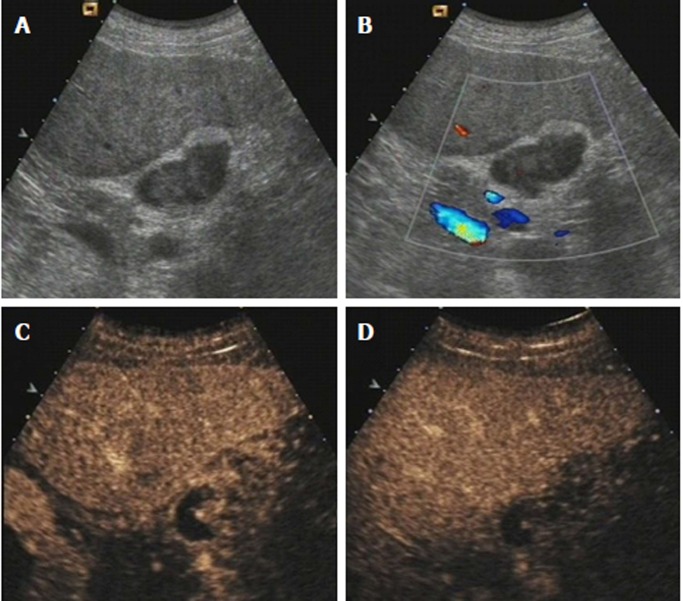 Figure 4