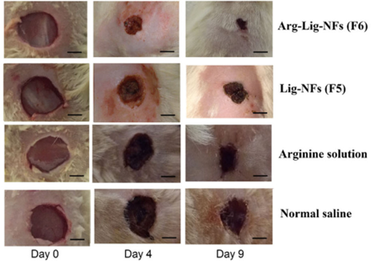 Figure 14