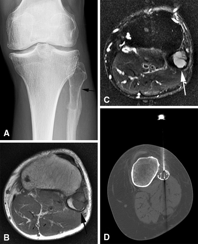 Fig. 2A–D