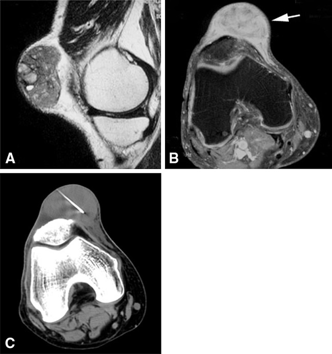 Fig. 1A–C