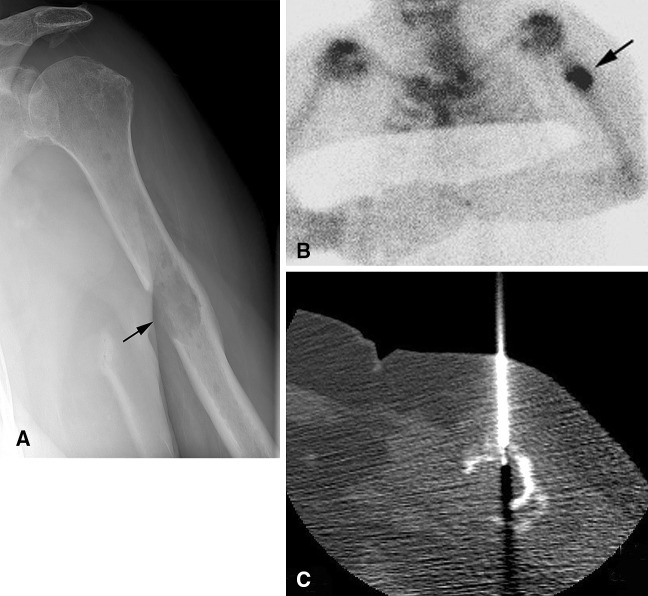 Fig. 4A–C