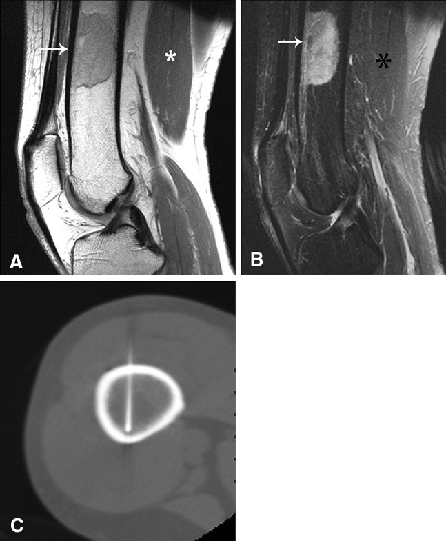 Fig. 3A–C