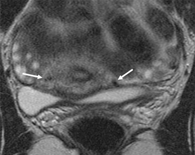 Figure 2b: