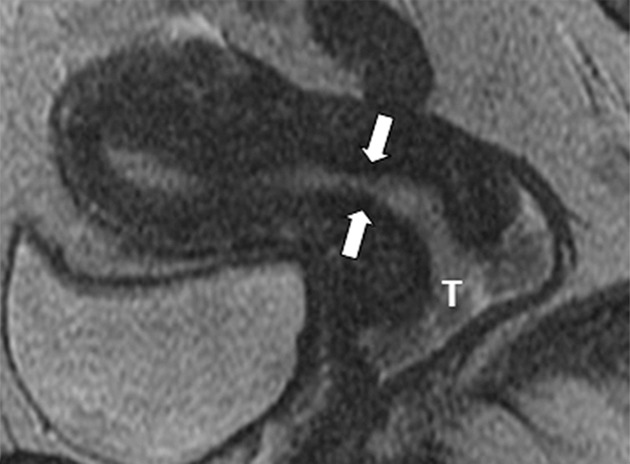 Figure 1a: