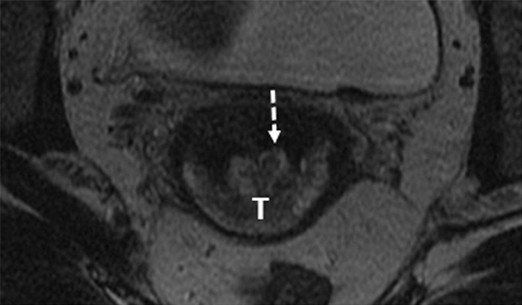 Figure 1c: