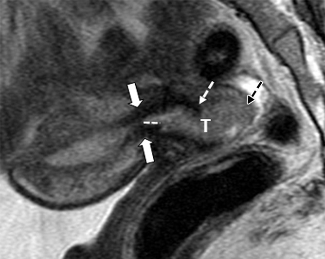 Figure 2a: