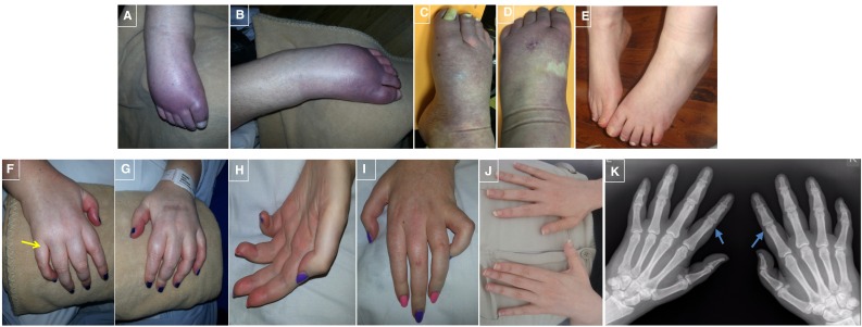 Fig. 1