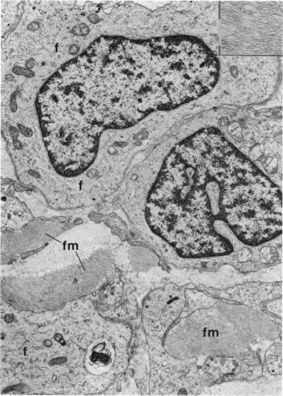 FIGURE 45