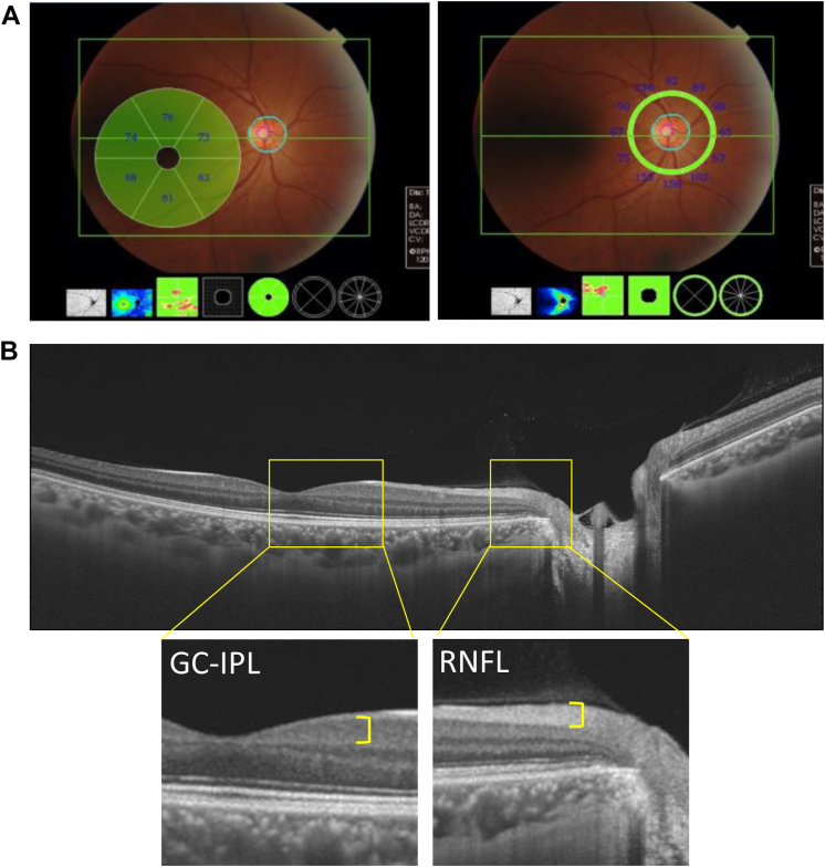 Figure 1