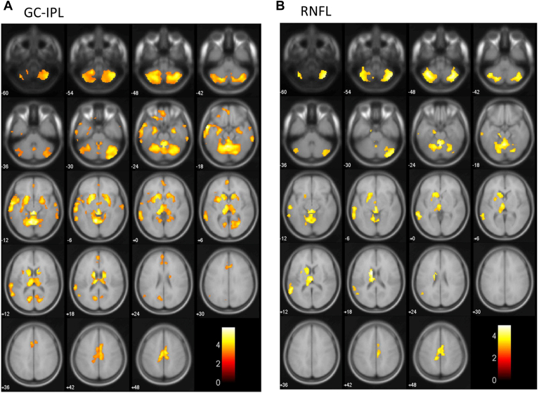 Figure 3