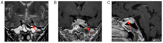 Figure 2.