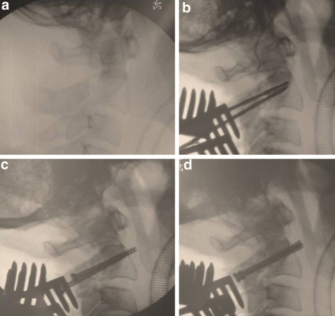 Fig. 2