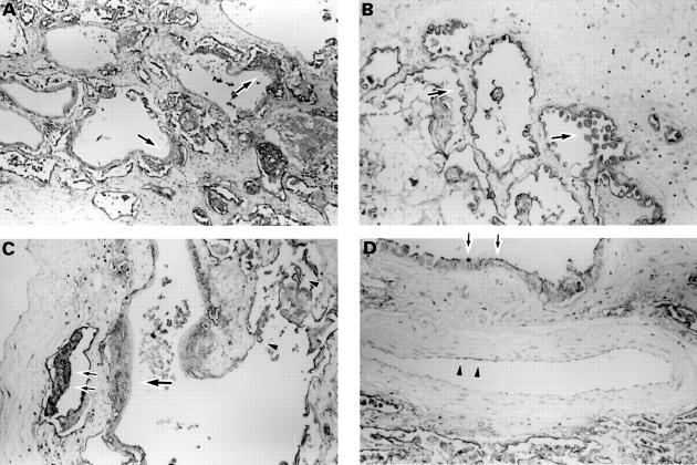 Figure 4  