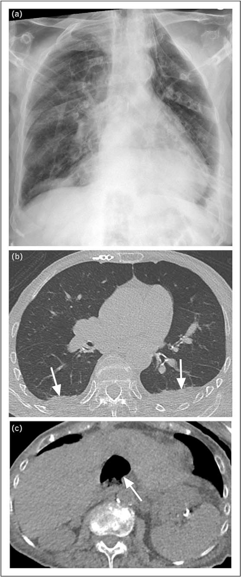 FIGURE 1