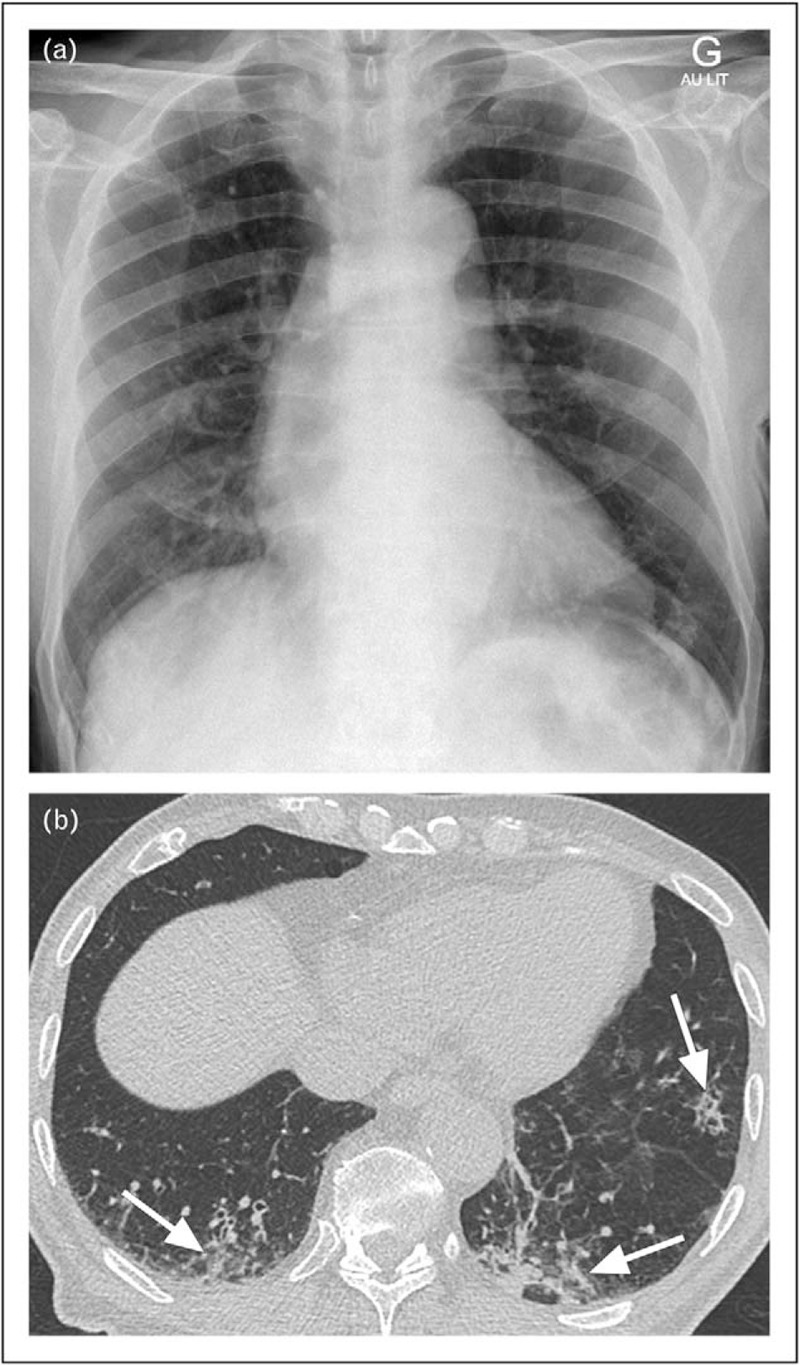 FIGURE 2