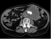 Fig 1