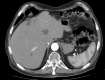 Fig 2