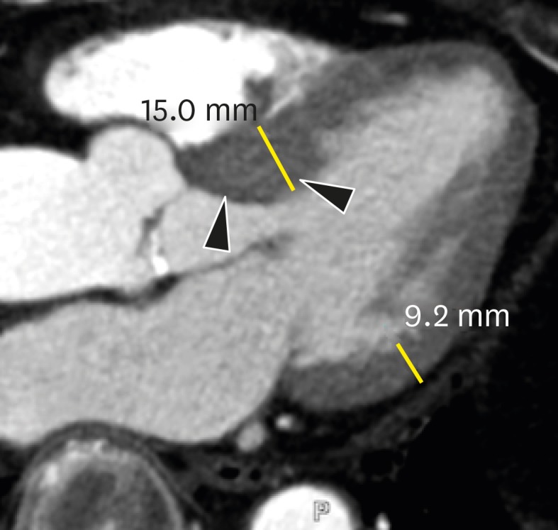 Figure 17