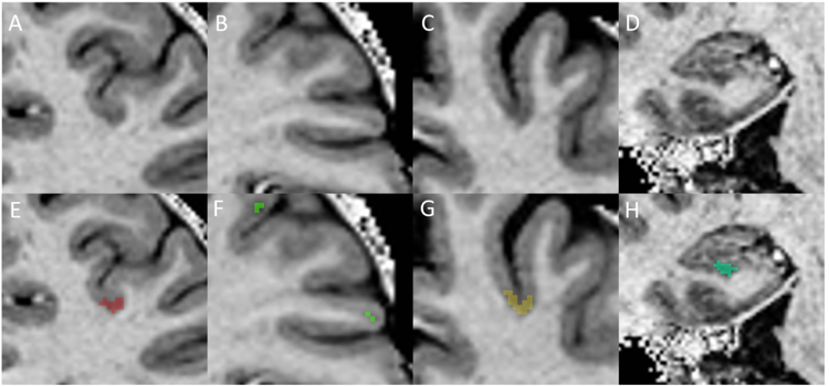 Figure 3: