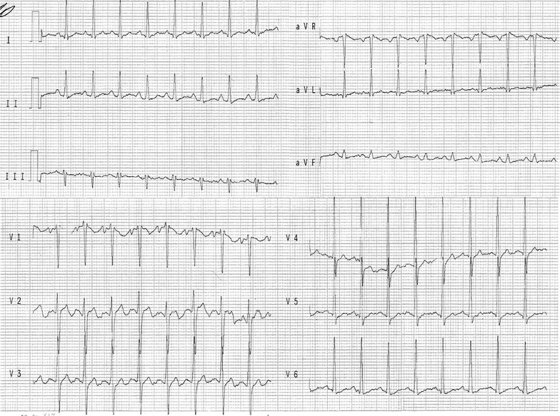 Fig. 2