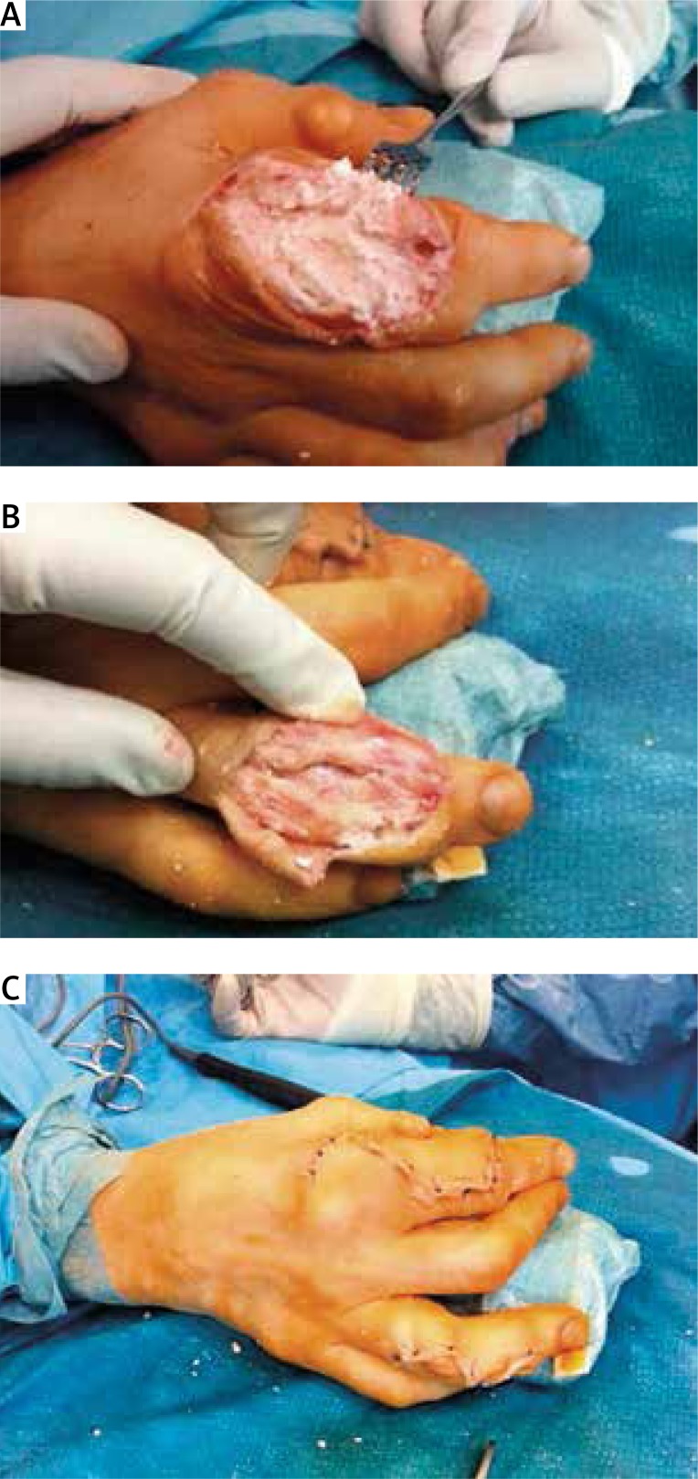 Fig. 2