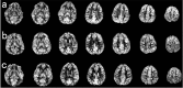 Fig. (3)