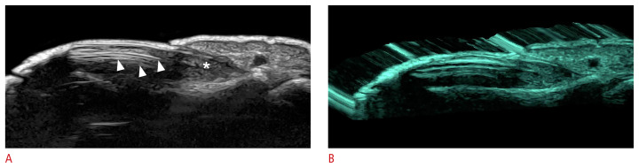 Fig. 18