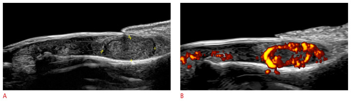 Fig. 17